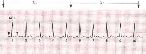 Определение частоты ритма сердца